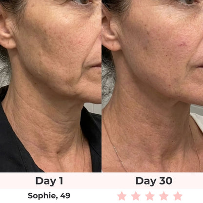 Koreluz COVE 7-IN-1 LED FACIAL SCULPTOR
